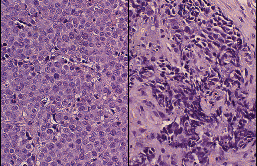 Normal Prostate Cells