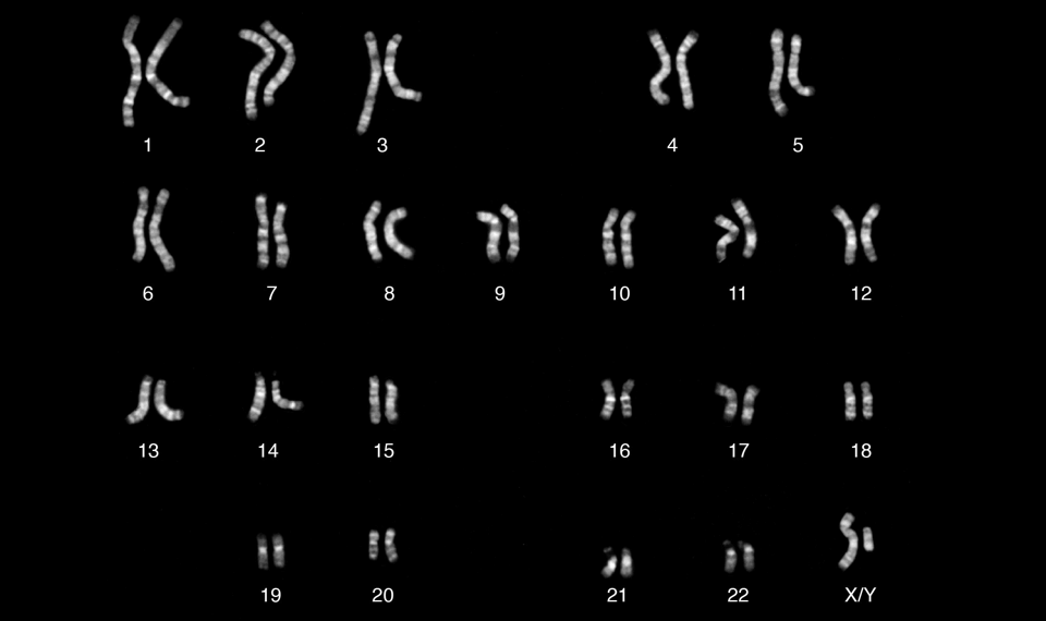 The Y Chromosome’s Still-Uncharted Regions
