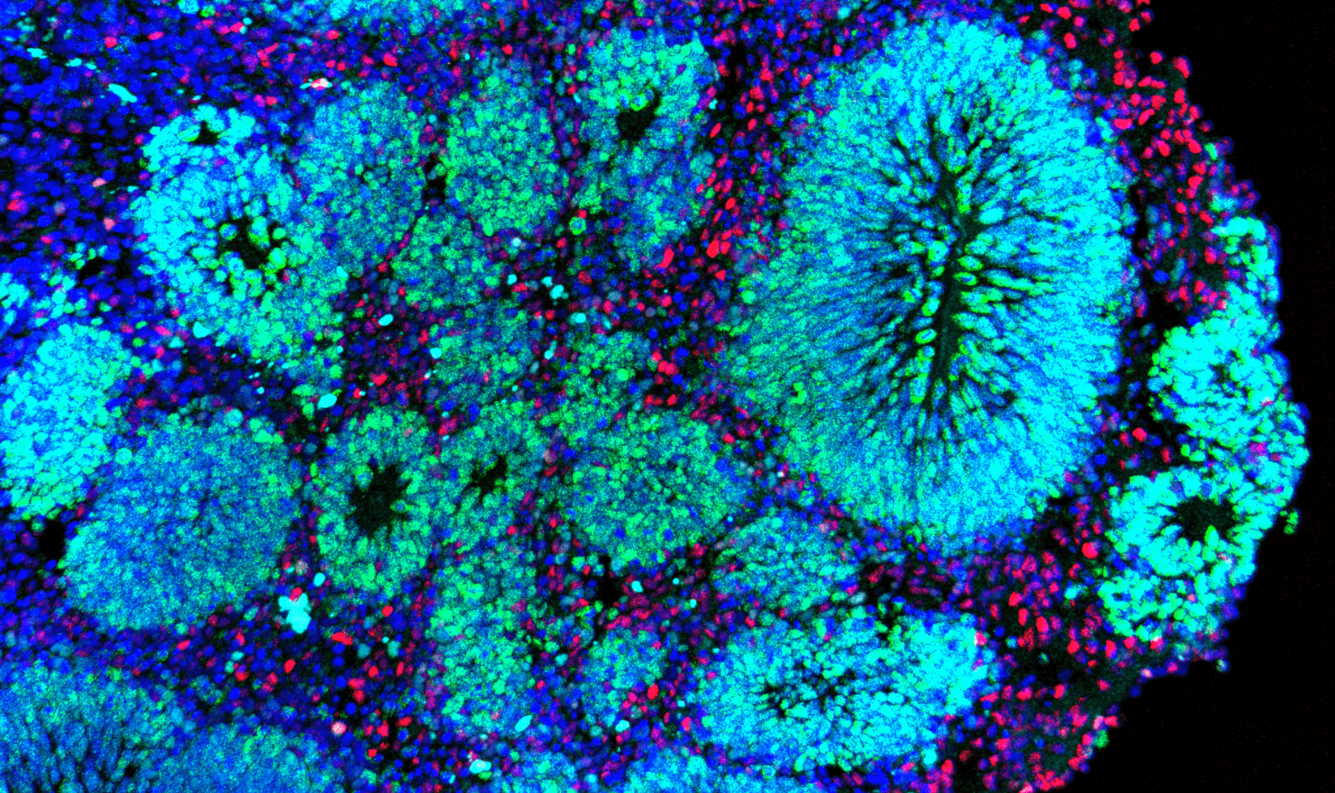 A cluster of blue, green, and red cells