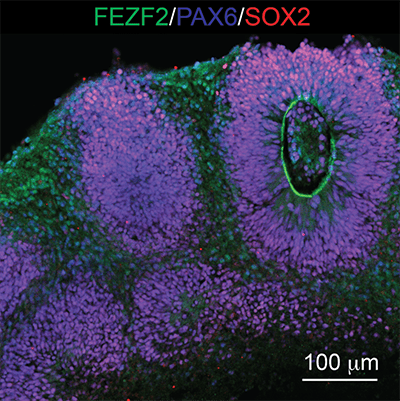 image of a cortical organoid grown
